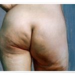 Cadrage resserré de l'étude des fesses de Vallotton